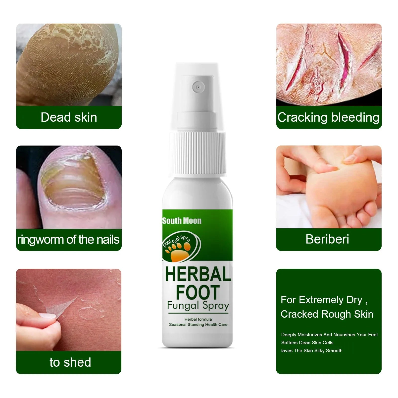 30ml foot skin nourishing and hydrating care spray in portable bottle