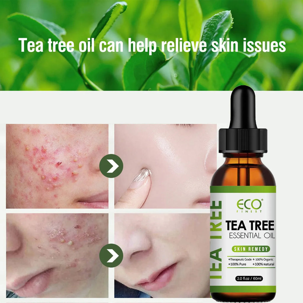 60ml tea tree essential oil bottle for facial acne treatment and massage application