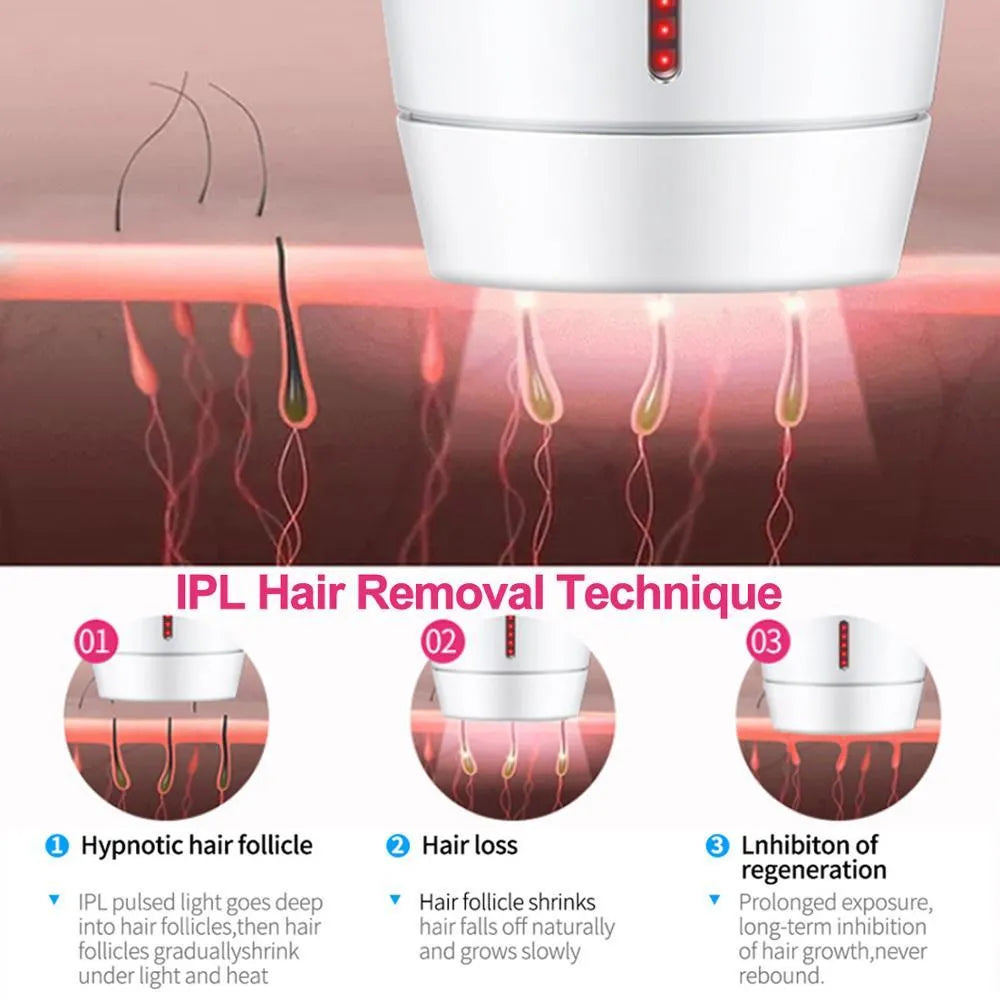 White home IPL laser hair removal device on a table