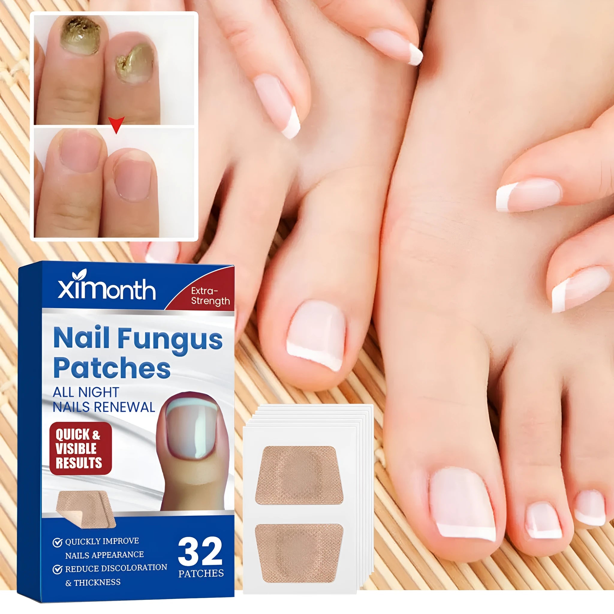 Box of 32 nail repair adhesive bandages with natural extracts for damaged fingernails and toenails