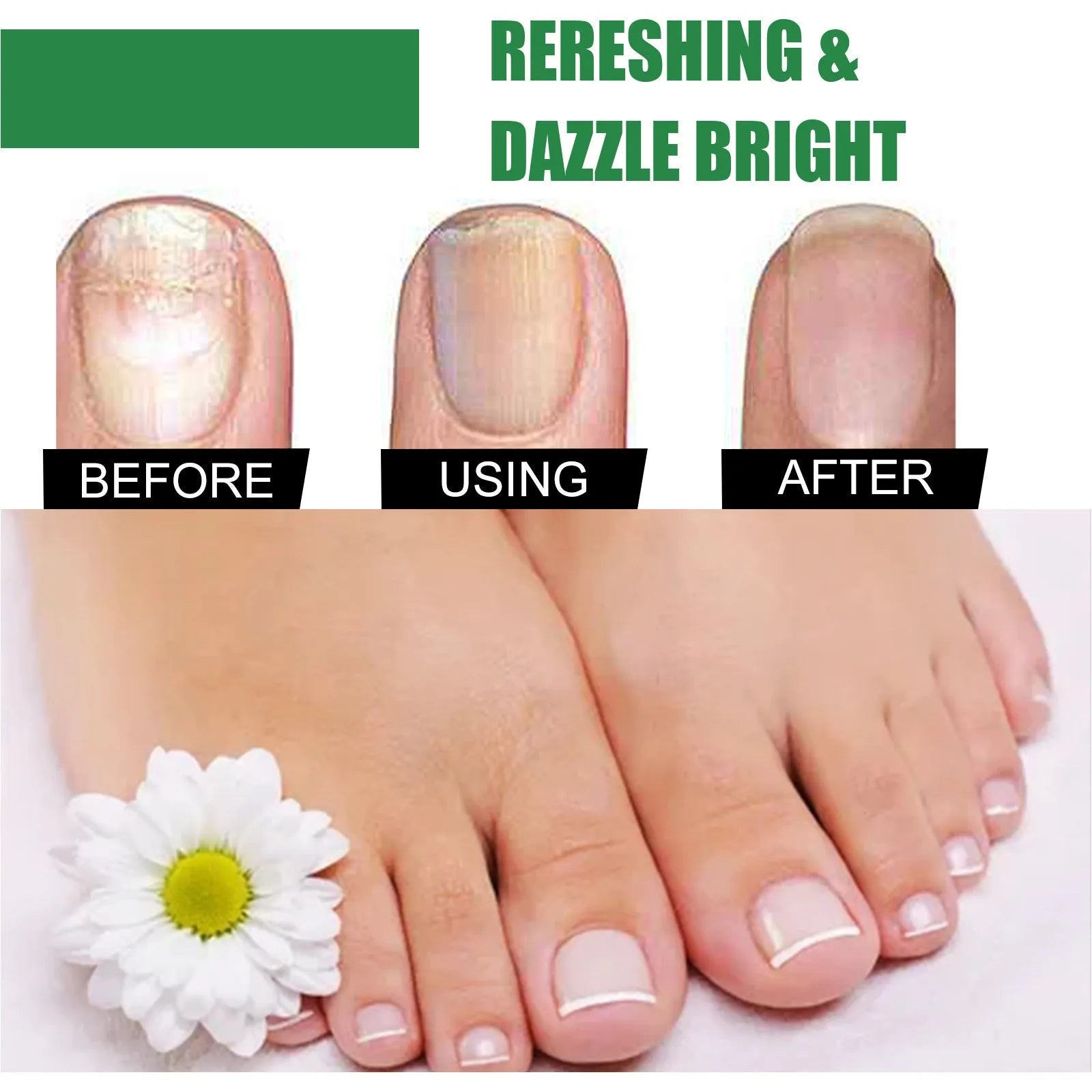 30ml tea tree oil foot and nail care repair fluid bottle