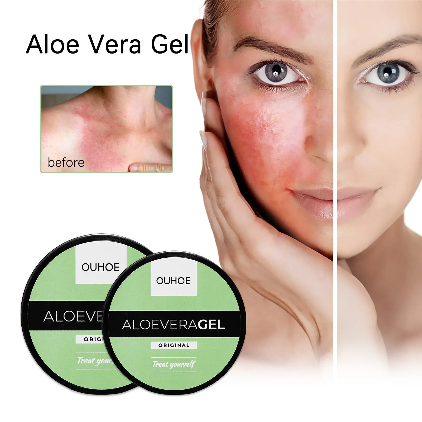 Aloe vera gel and tanning cream bottles for after-sun repair and natural tanning.