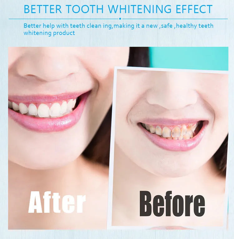 Toothbrush teeth whitening pen in gold aluminium case with whitening gel