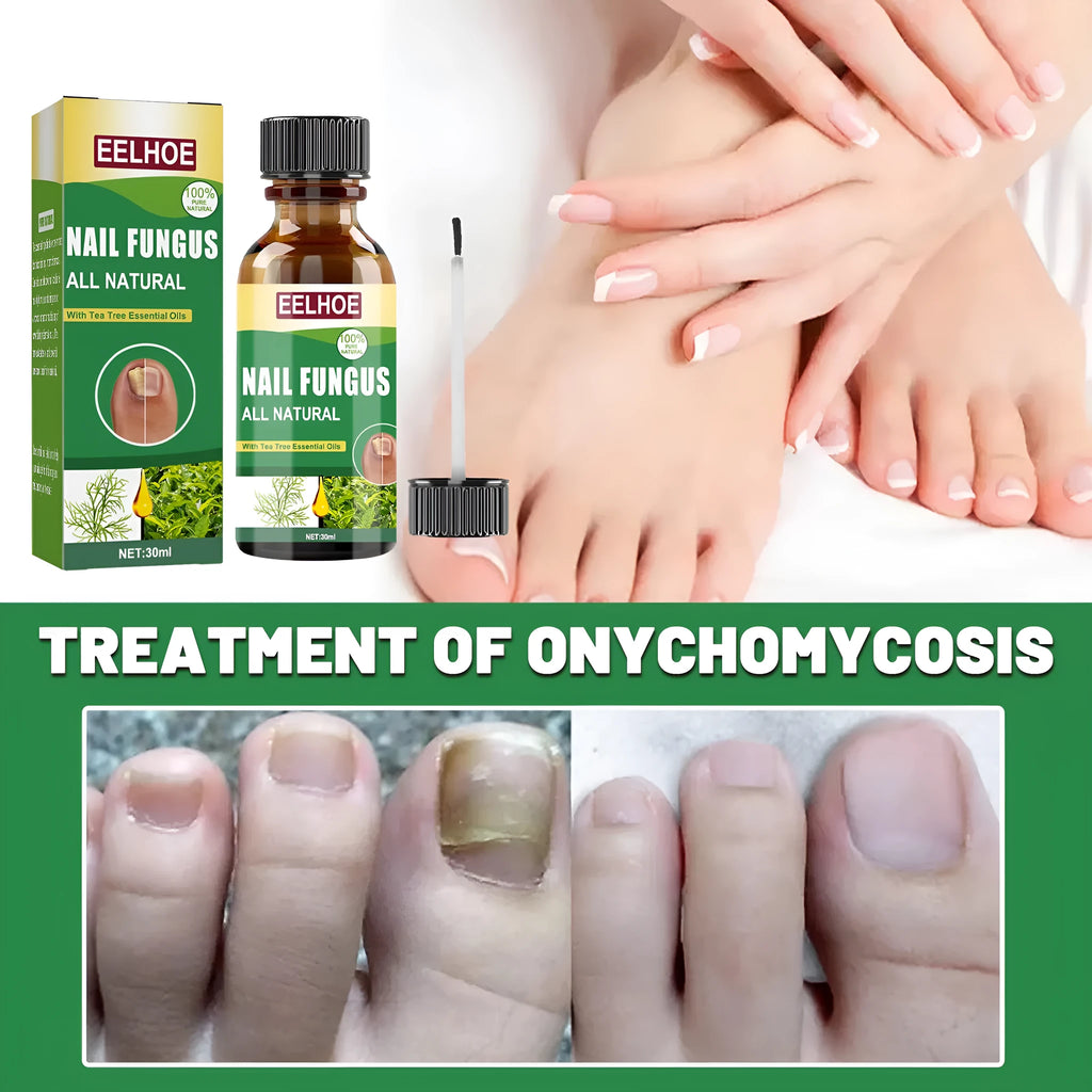 30ml tea tree oil foot and nail care repair fluid bottle
