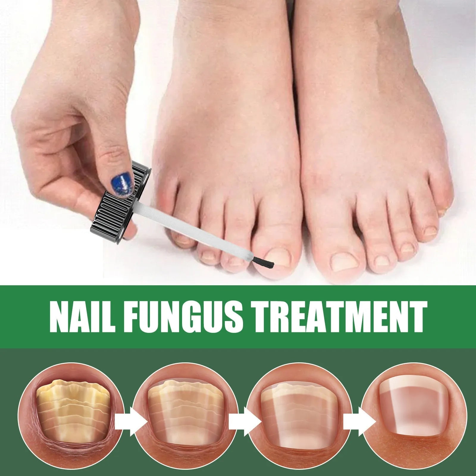 30ml tea tree oil foot and nail care repair fluid bottle
