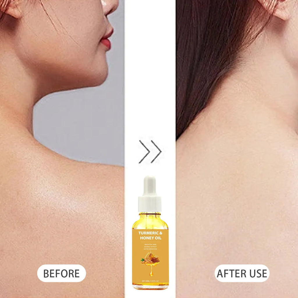 Turmeric honey essential oil 30ml in amber glass bottle with dropper for facial application