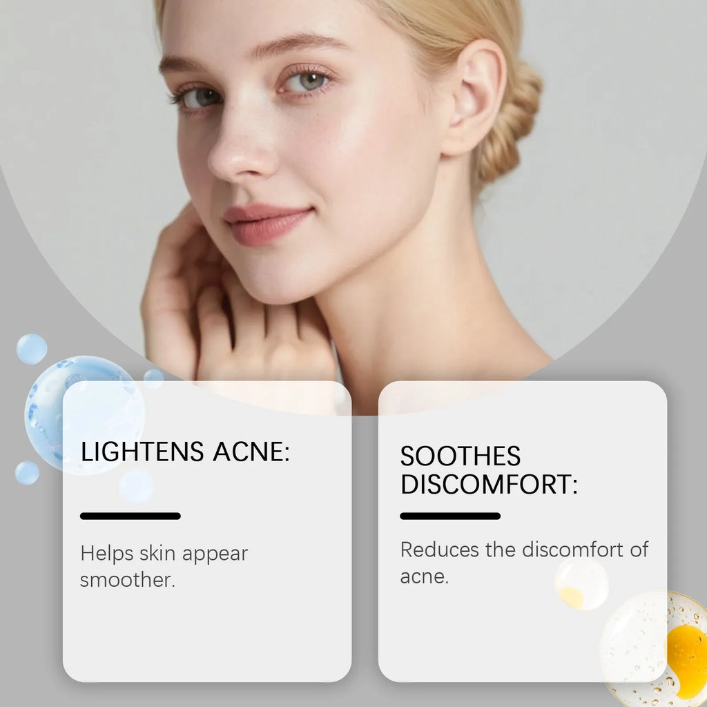 Transparent hydrocolloid facial acne patches pack with 80 count for spot treatment