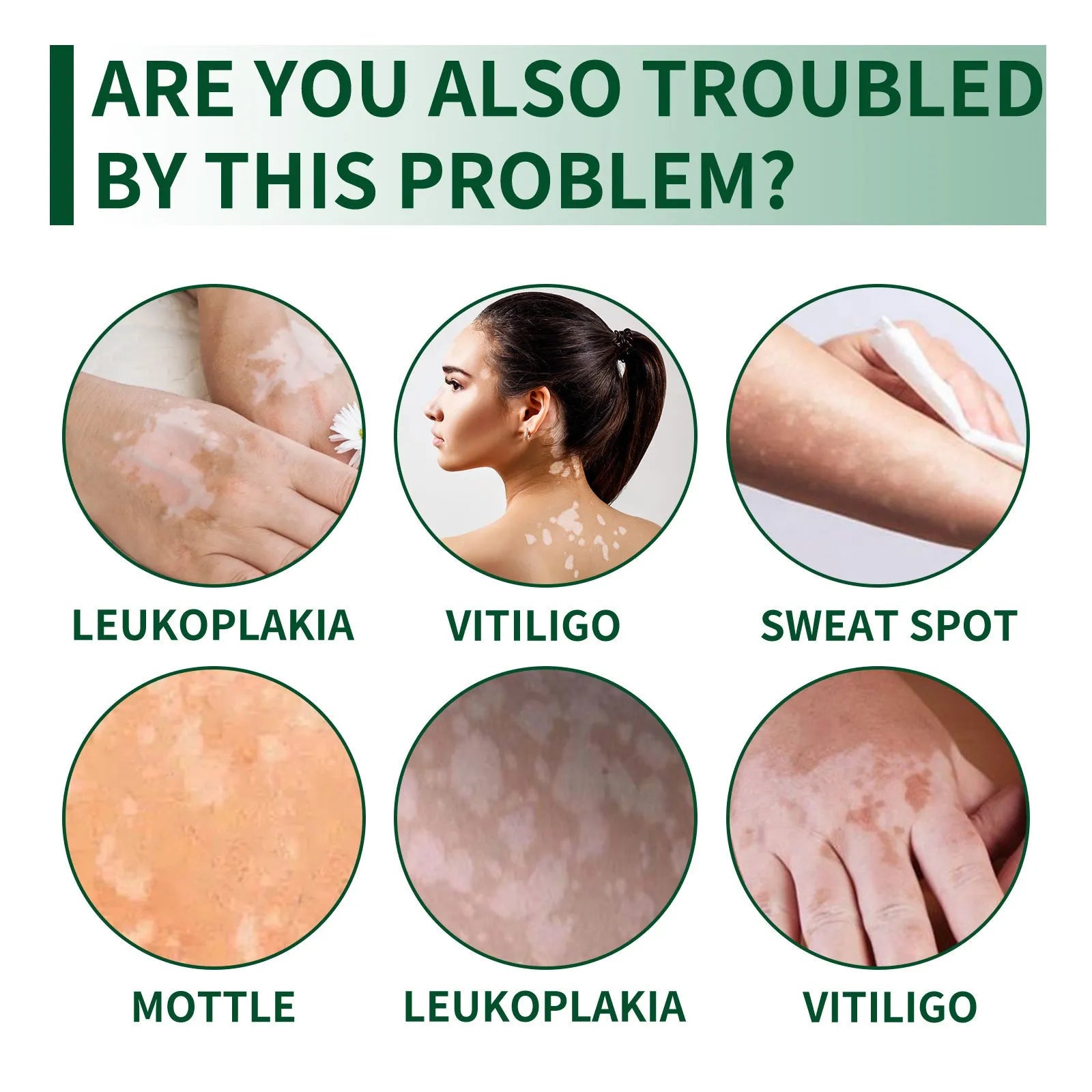 35g pot of nursing cream for body skin cleansing and moisturising.