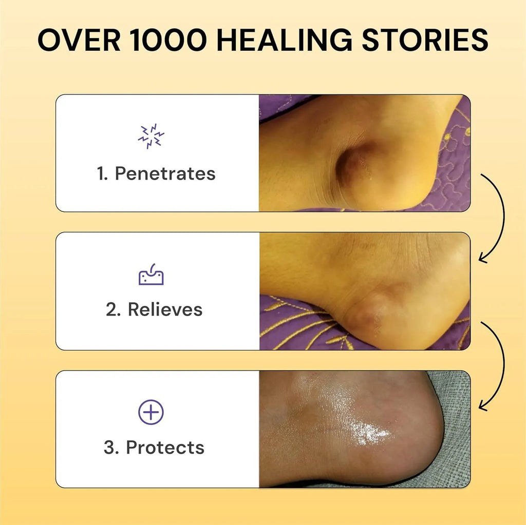 120g tube of Flare Care muscle and joint pain relief cream with no visible branding