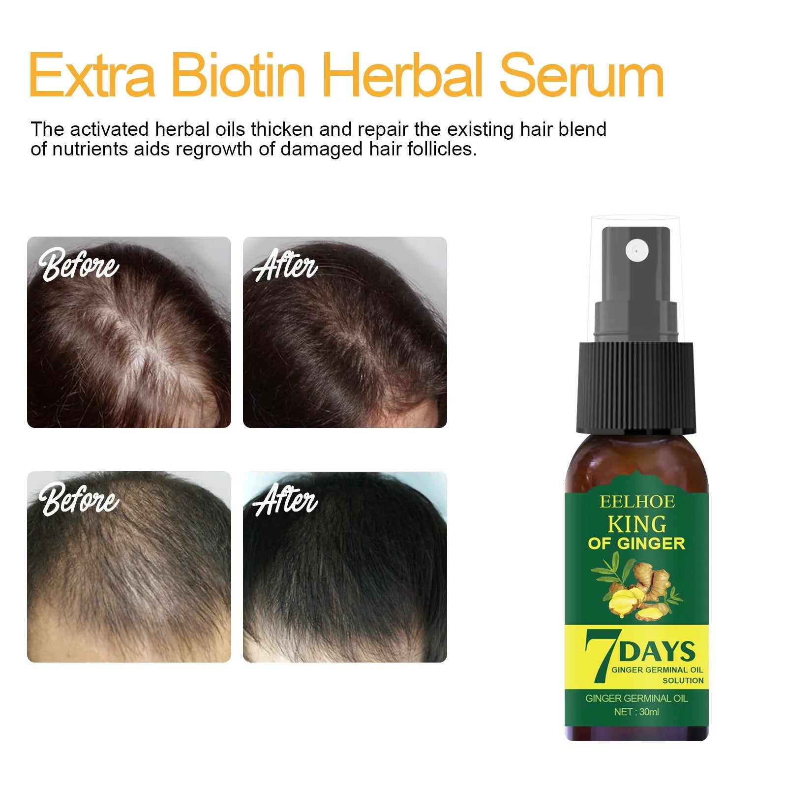EELHOE ginger nutrition spray in 30ml and 50ml bottles for hair root moisture and damage care.