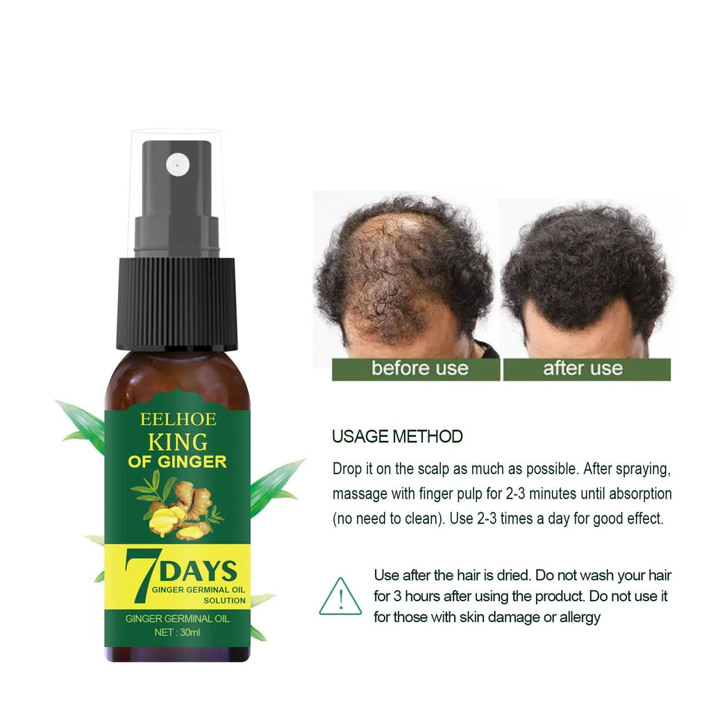 EELHOE ginger nutrition spray in 30ml and 50ml bottles for hair root moisture and damage care.